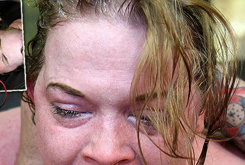 Facial Abuse Destroys Ariel Stonem